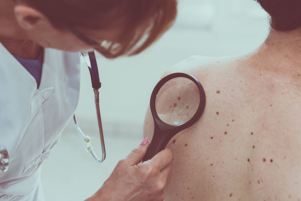 Quais são os tipos de tratamento para o câncer de pele?