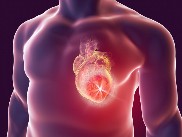 Tumor cardíaco: existe câncer no coração? Entenda melhor!