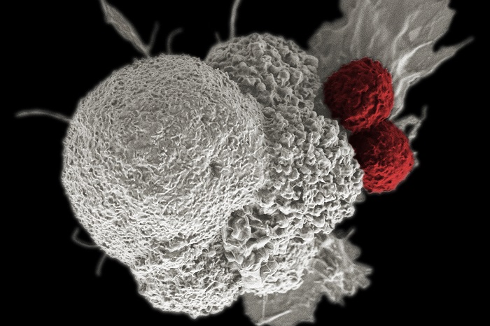 Imunoterapia: o que é e como ela funciona contra o câncer