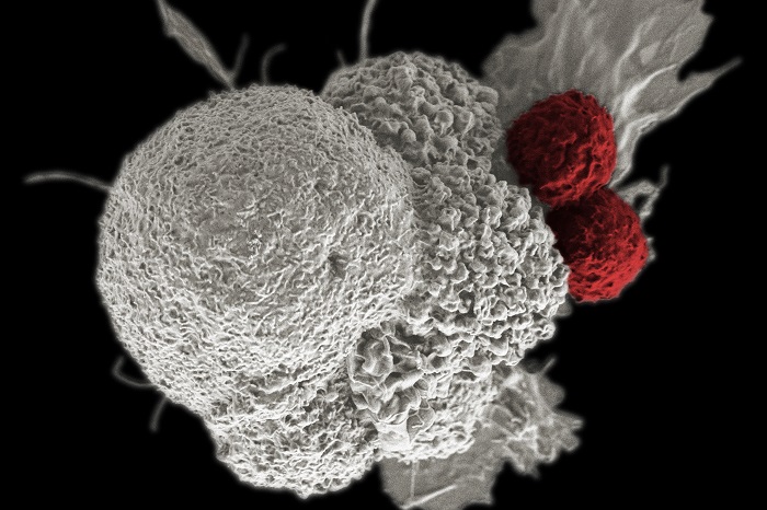 A imunoterapia é um dos tratamentos da oncologia dentro do conceito de multidisciplinaridade